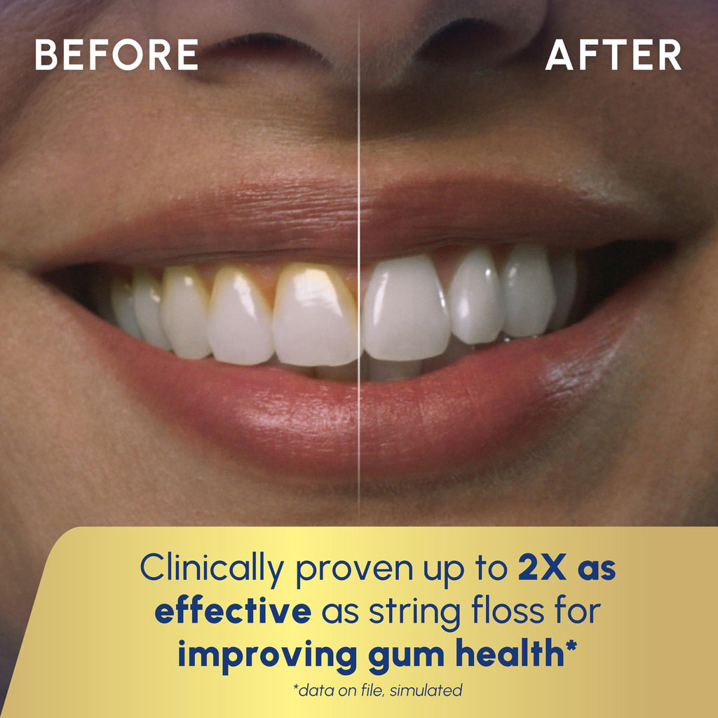 WATERPIK Cordless Water Flosser for Teeth and Gums